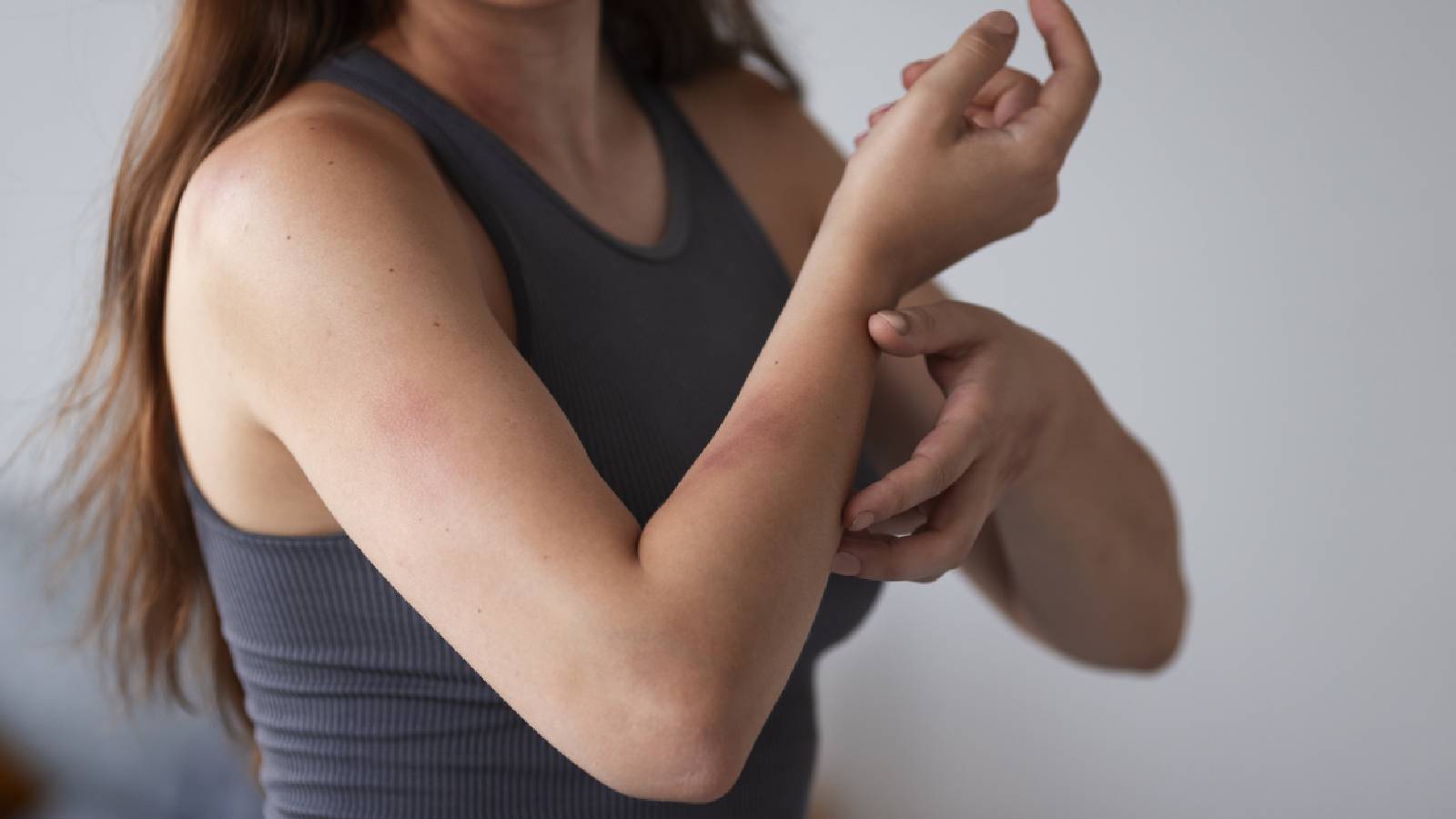 Skin rashes: Types, Causes, Diagnosis, Treatment Globalindianews24